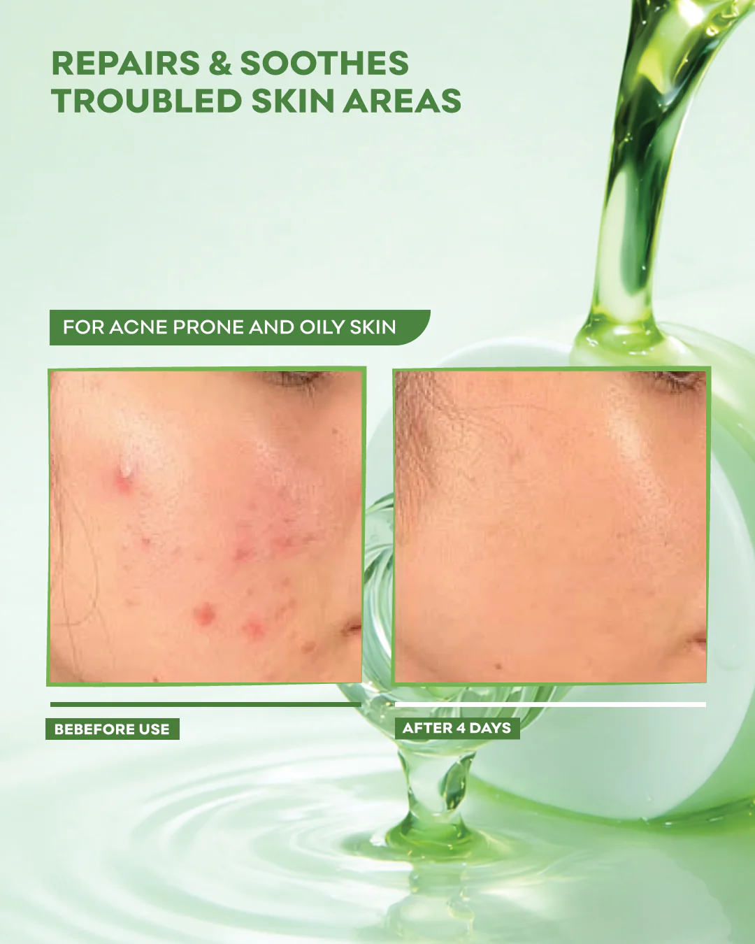 Acne Repair Serum - Image 3