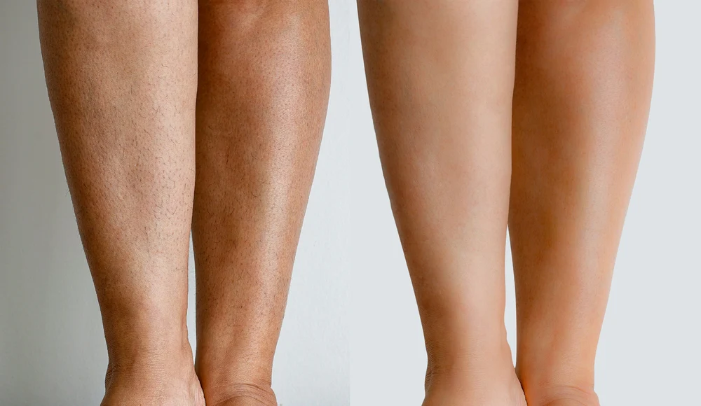 Painless Cream Wax - Image 5